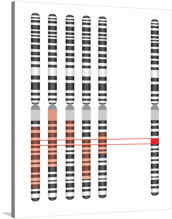 Description of the general procedure used to identify a disease gene. Regions of the genome (highlighted in red) that could theoretically harbor the disease gene are identified in many affected individuals. Any area where these regions overlap has a high probability of containing the disease gene of interest.