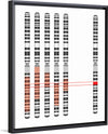 "Disease Gene Mapping with Multiple Chromosomes"