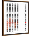 "Disease Gene Mapping with Multiple Chromosomes"