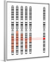 "Disease Gene Mapping with Multiple Chromosomes"