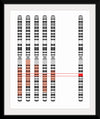 "Disease Gene Mapping with Multiple Chromosomes"