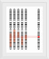 "Disease Gene Mapping with Multiple Chromosomes"