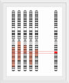 "Disease Gene Mapping with Multiple Chromosomes"