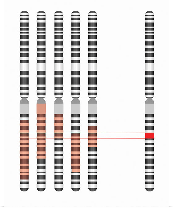 "Disease Gene Mapping with Multiple Chromosomes"